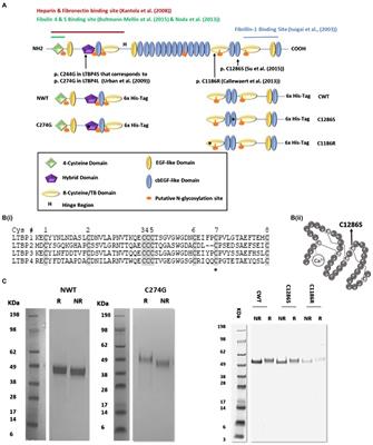 Autosomal Recessive Cutis Laxa 1C Mutations Disrupt the Structure and Interactions of Latent TGFβ Binding Protein-4